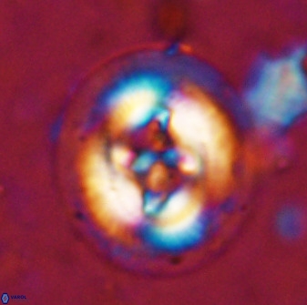 Cruciplacolithus tenuis 50410