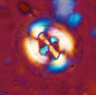 Cruciplacolithus tenuis 50411