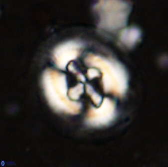 Cruciplacolithus tenuis 50412