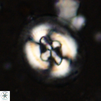 Cruciplacolithus tenuis 50412