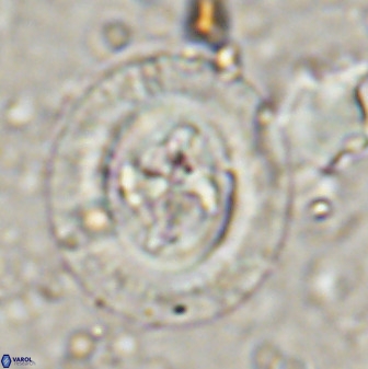 Cruciplacolithus tenuis 50417