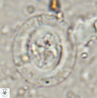 Cruciplacolithus tenuis 50417