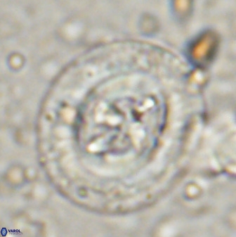 Cruciplacolithus tenuis 50418