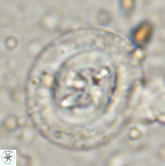 Cruciplacolithus tenuis 50418