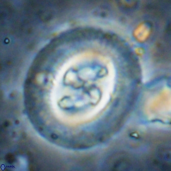 Cruciplacolithus tenuis 50419