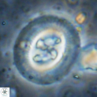 Cruciplacolithus tenuis 50419