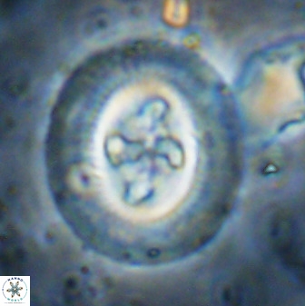 Cruciplacolithus tenuis 50420