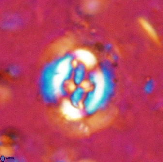 Cruciplacolithus tenuis 50516