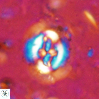 Cruciplacolithus tenuis 50516