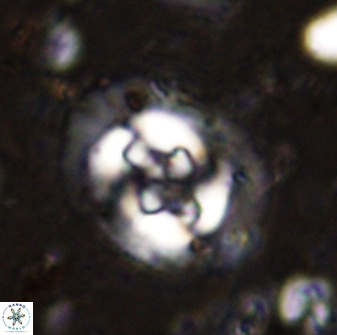 Cruciplacolithus tenuis 50518