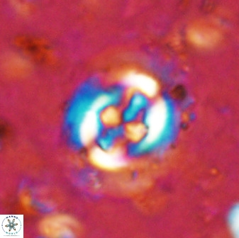 Cruciplacolithus tenuis 50520