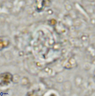 Cruciplacolithus tenuis 50521