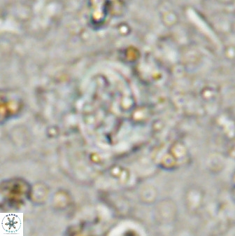Cruciplacolithus tenuis 50521