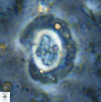 Cruciplacolithus tenuis 50522