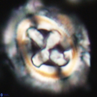 Cruciplacolithus tenuis 22221