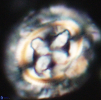 Cruciplacolithus tenuis 22222