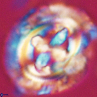 Cruciplacolithus tenuis 22223