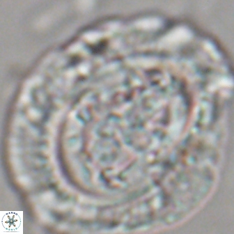 Cruciplacolithus tenuis 22224