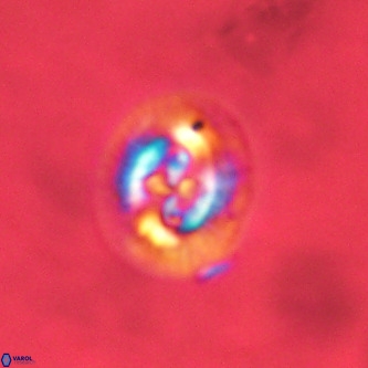 Cruciplacolithus tenuis VR 00968