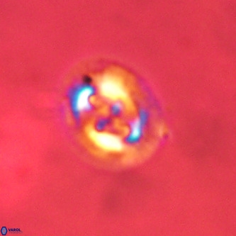 Cruciplacolithus tenuis VR 00969