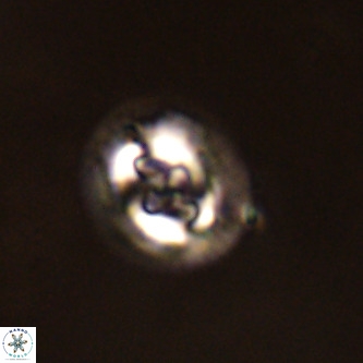 Cruciplacolithus tenuis VR 00970