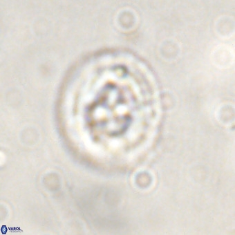 Cruciplacolithus tenuis VR 00975