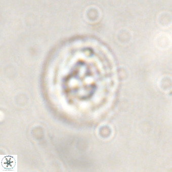 Cruciplacolithus tenuis VR 00975
