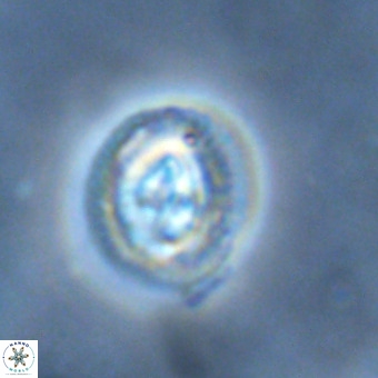 Cruciplacolithus tenuis VR 00981