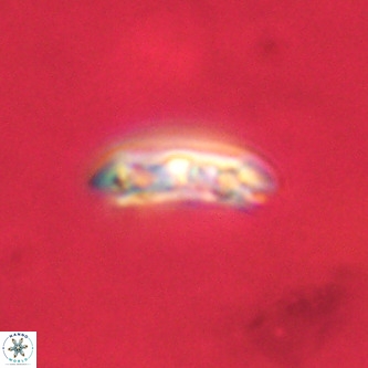 Cruciplacolithus tenuis VR 00984