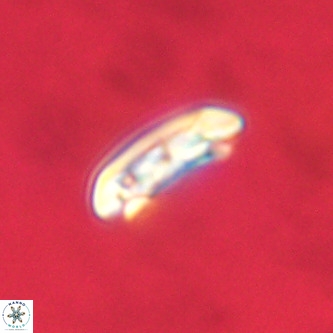 Cruciplacolithus tenuis VR 00985