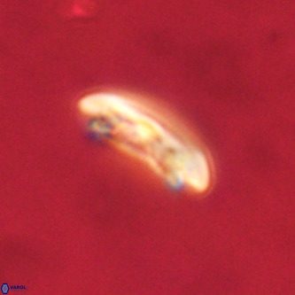 Cruciplacolithus tenuis VR 00988