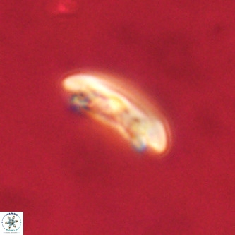 Cruciplacolithus tenuis VR 00988
