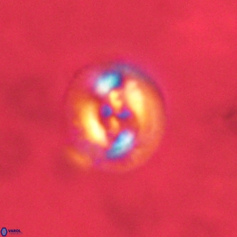 Cruciplacolithus tenuis VR 00996