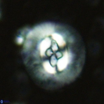 Cruciplacolithus cf_intermedius VR 07128