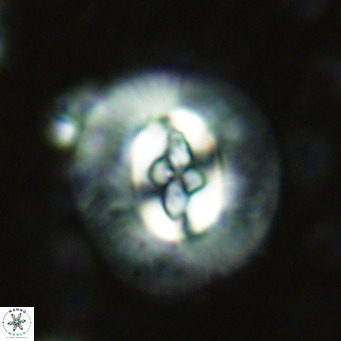 Cruciplacolithus cf_intermedius VR 07128