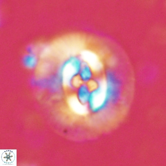 Cruciplacolithus tenuis VR 07129