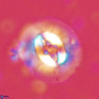 Cruciplacolithus tenuis VR 07130