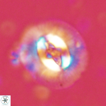Cruciplacolithus tenuis VR 07130