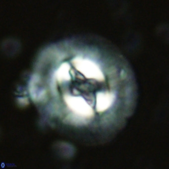 Cruciplacolithus tenuis VR 07131