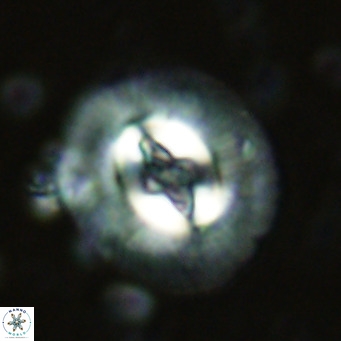 Cruciplacolithus tenuis VR 07131