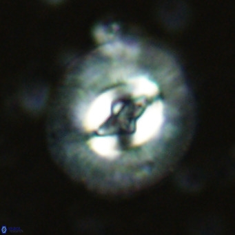 Cruciplacolithus tenuis VR 07133