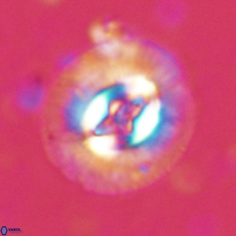 Cruciplacolithus tenuis VR 07134