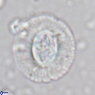 Cruciplacolithus tenuis VR 07135