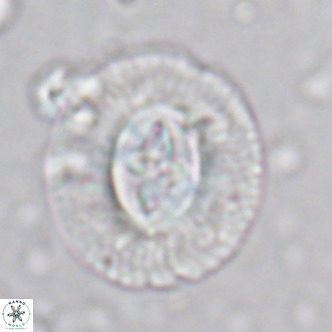 Cruciplacolithus tenuis VR 07135