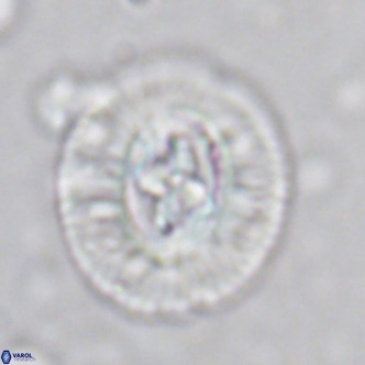 Cruciplacolithus tenuis VR 07136