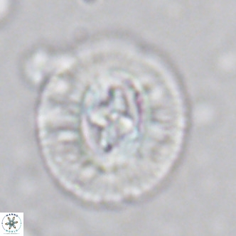 Cruciplacolithus tenuis VR 07136