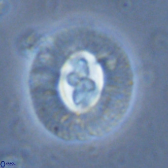 Cruciplacolithus tenuis VR 07137