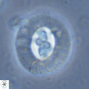 Cruciplacolithus tenuis VR 07137