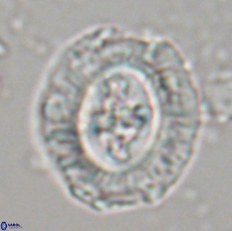 Cruciplacolithus tenuis 21709