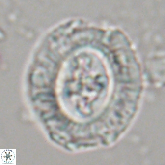 Cruciplacolithus tenuis 21709